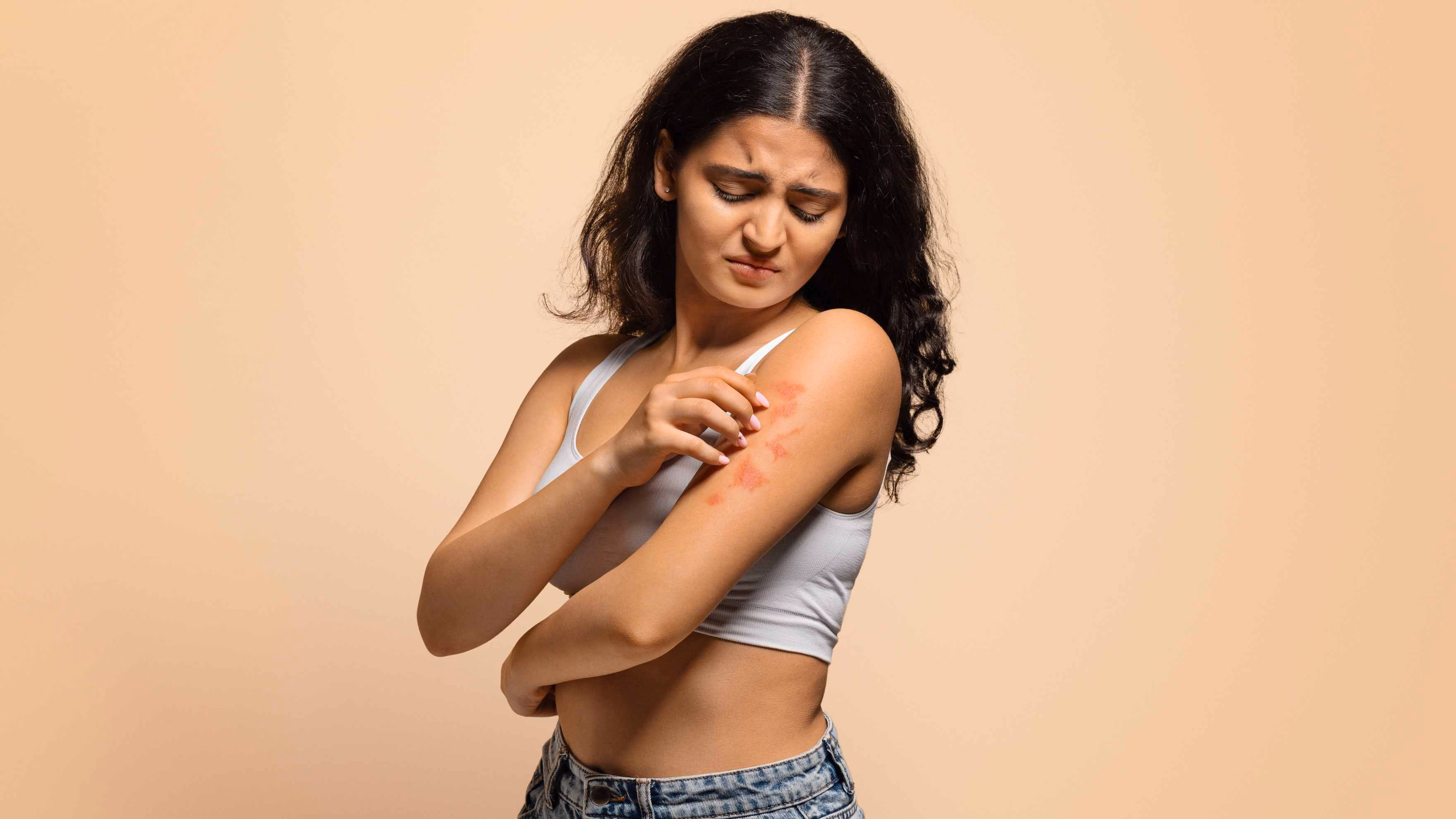 How to Treat a Burning Sensation on Skin Quickly and Safely