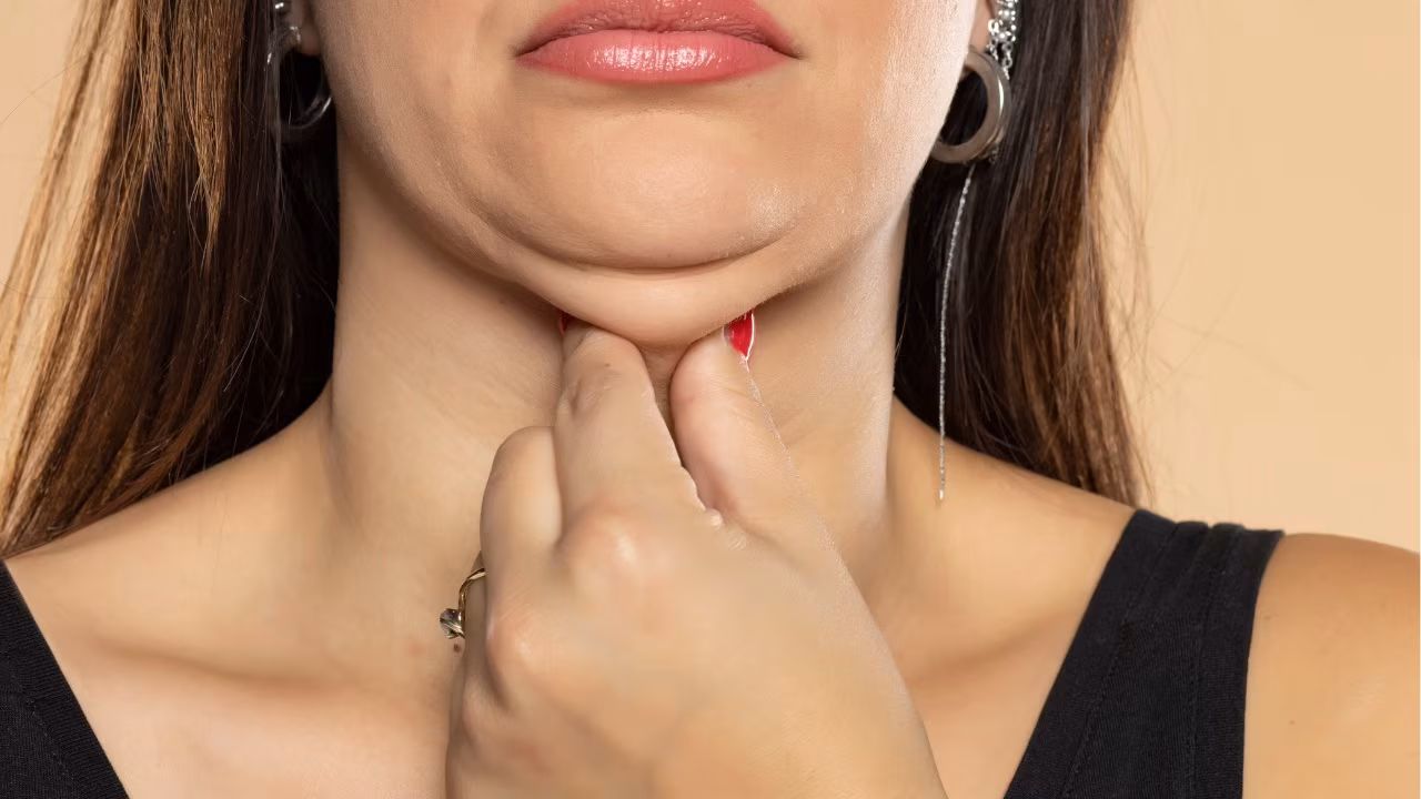 What Causes a Double Chin and How to Avoid It